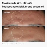 ORD-NIACINAMIDE-HA-SET